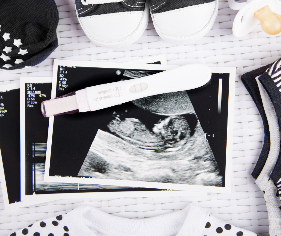 black and white ultrasound photo with positive pregnancy test on top
